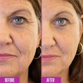 Before and after comparison of a woman's face with visible aging changes.