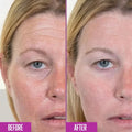Before and after comparison of a woman's face with visible skin texture differences.