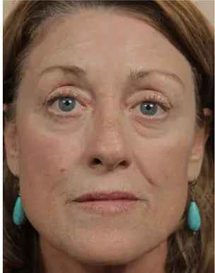 After - Patricia W