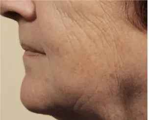 Before - Cheryl B