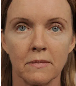 After - Renee H