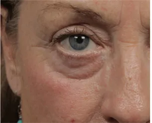 Before - Patricia W
