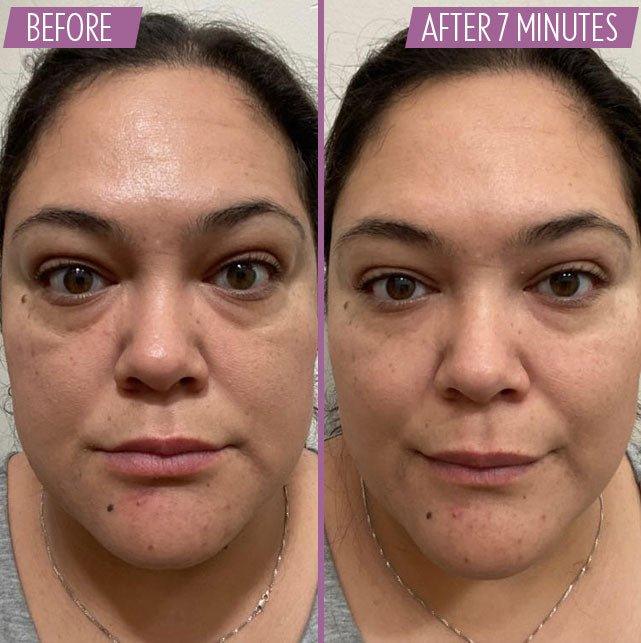 Before and after Full Face - Athena 7 Minute Lift by Adonia Organics